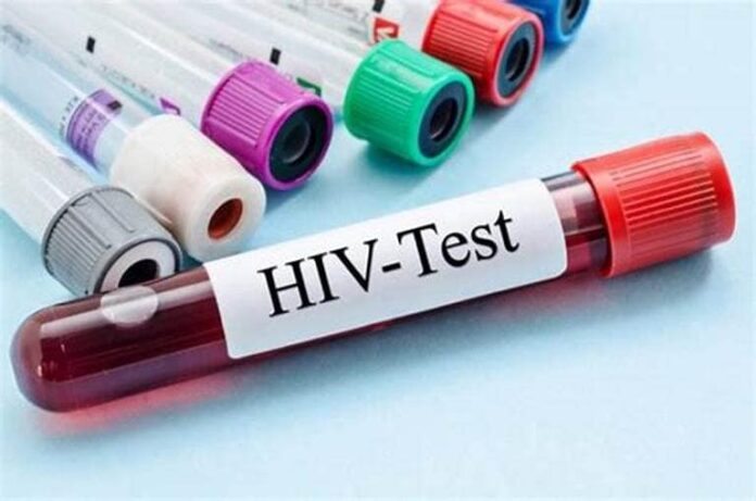 HIV.jpeg